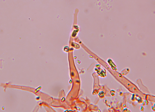 Phlebia subochracea